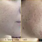 תמונה 2 בגלריה