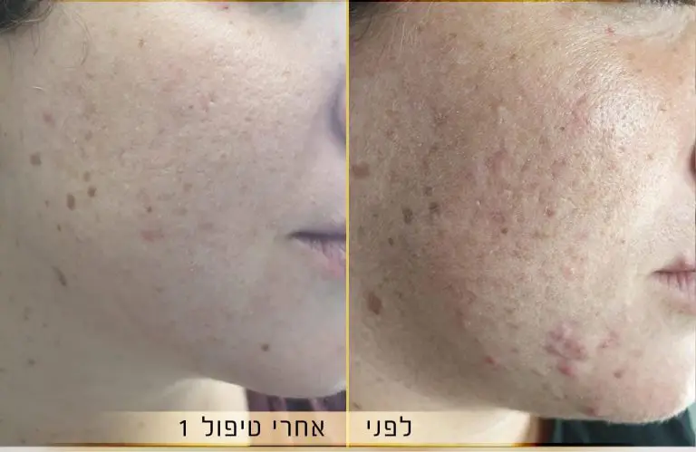 יפית נגד (תמונה 2 מתוך 4)