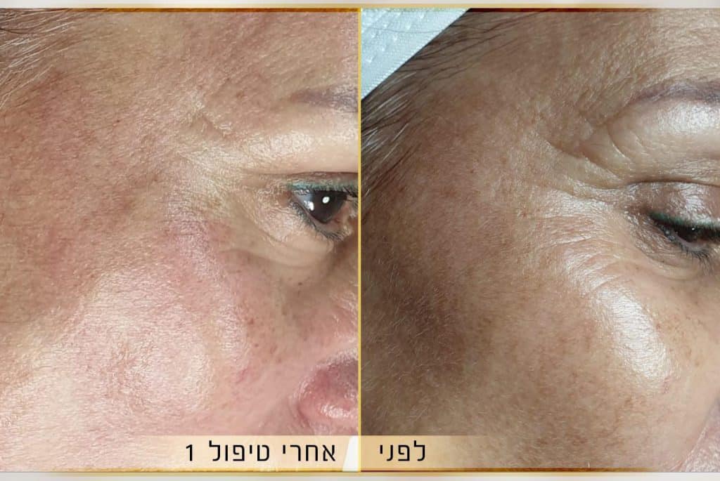יפית נגד (תמונה 1 מתוך 4)