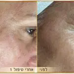 תמונה 1 בגלריה