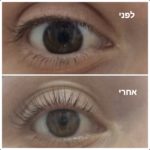 תמונה 4 בגלריה